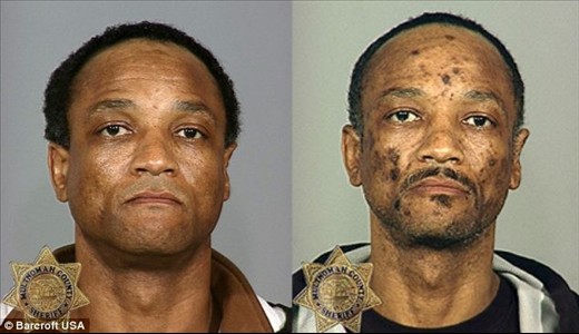 عکس: تاثیر مواد مخدر بر چهره معتادان! | www.Alamto.Com