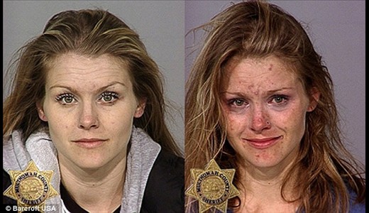 عکس: تاثیر مواد مخدر بر چهره معتادان!